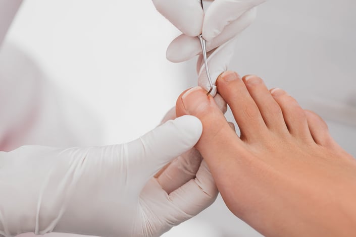 Cammo Podiatry Toenail Reconstruction