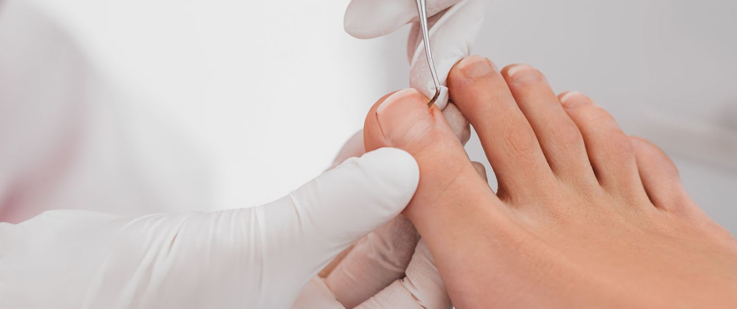 Cammo Podiatry Toenail Reconstruction